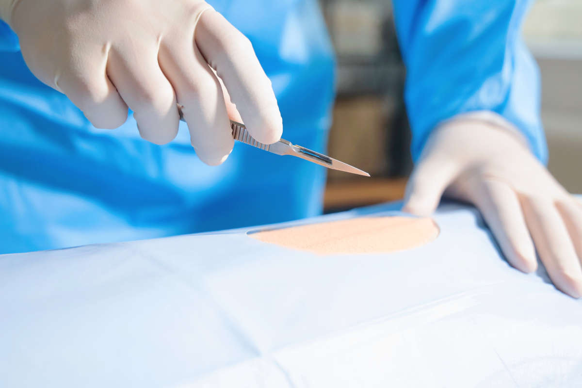 Quels sont les types de patients qui ont recours à la chirurgie ...