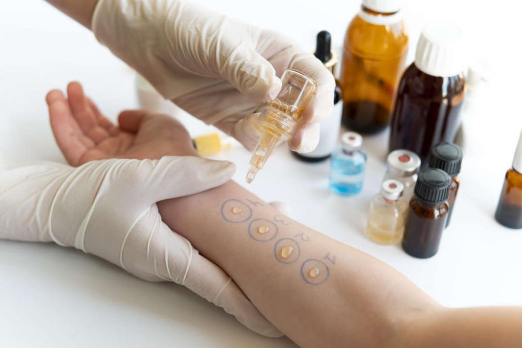 Les tests cutanés d’allergie : déroulement, types et interprétation – MDHP