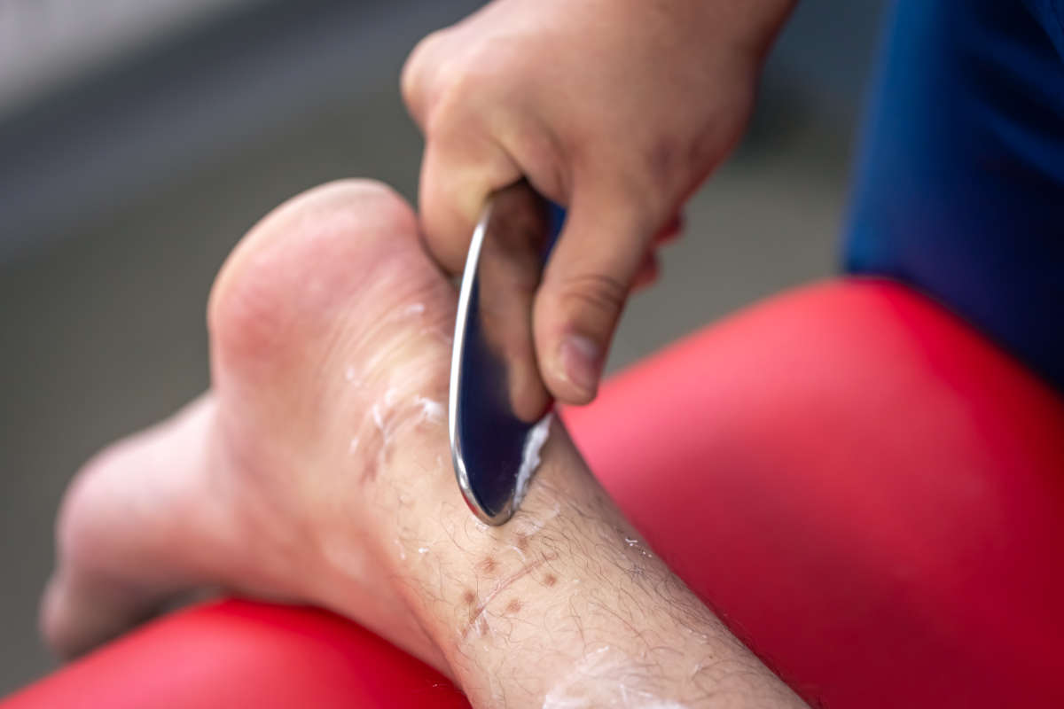Prévention et prise en charge de la mycose du pied – MDHP