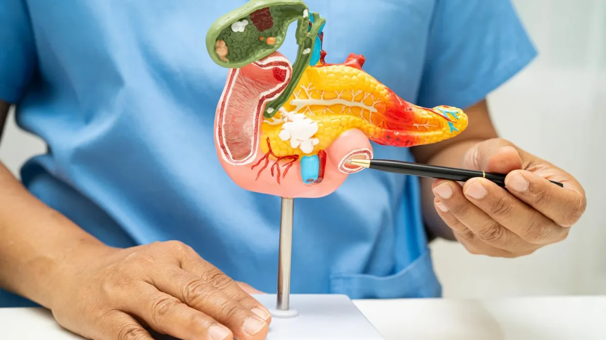 Cancer du pancréas : la survie médiane passe de 6,7 à 13,2 mois avec le daraxonrasib