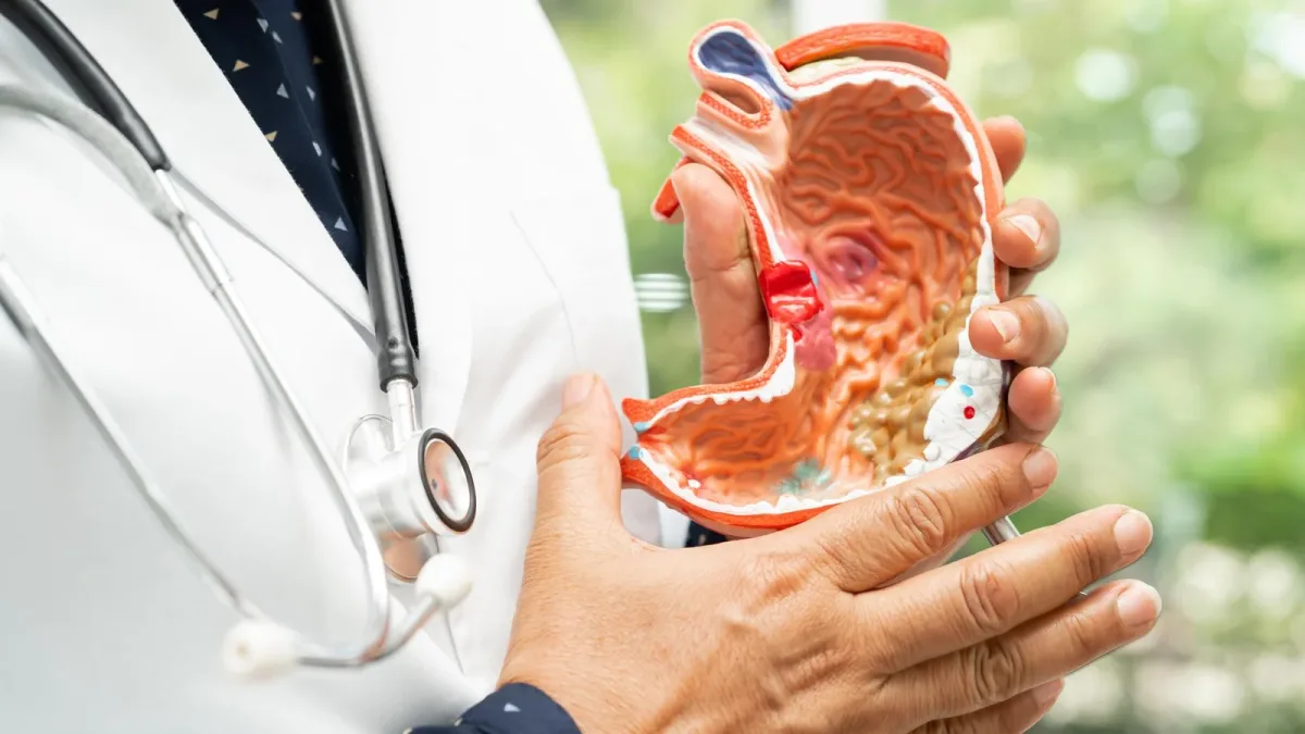Sodas quotidiens et cancer de l’estomac : 278 cas pour 112 284 personnes sur 36 ans