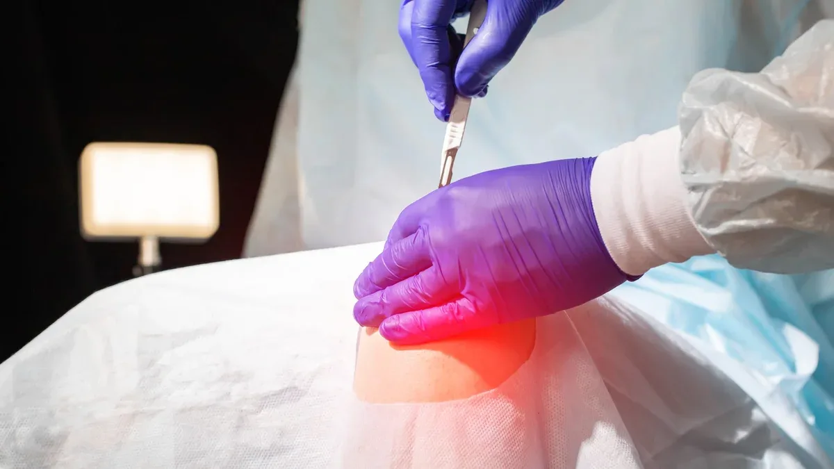 Doctor's hands with a scalpel near the patient's sore knee in the operating room Knee replacement concept arthroplasty