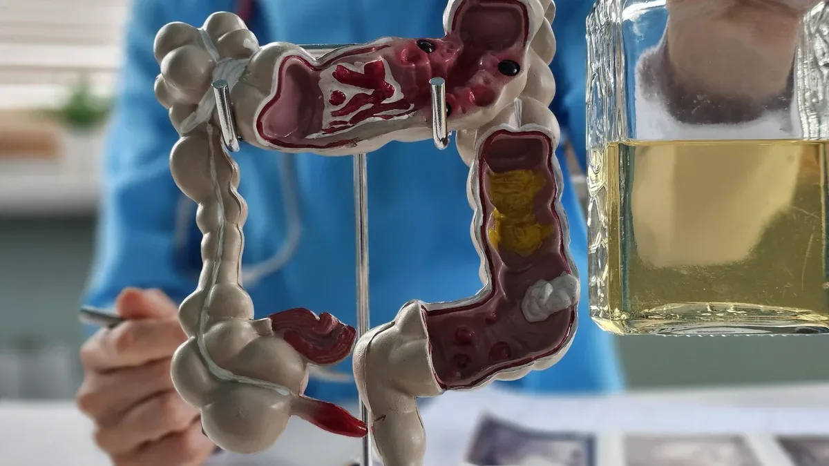 Le médecin tient un modèle du système digestif et une bouteille d'alcool