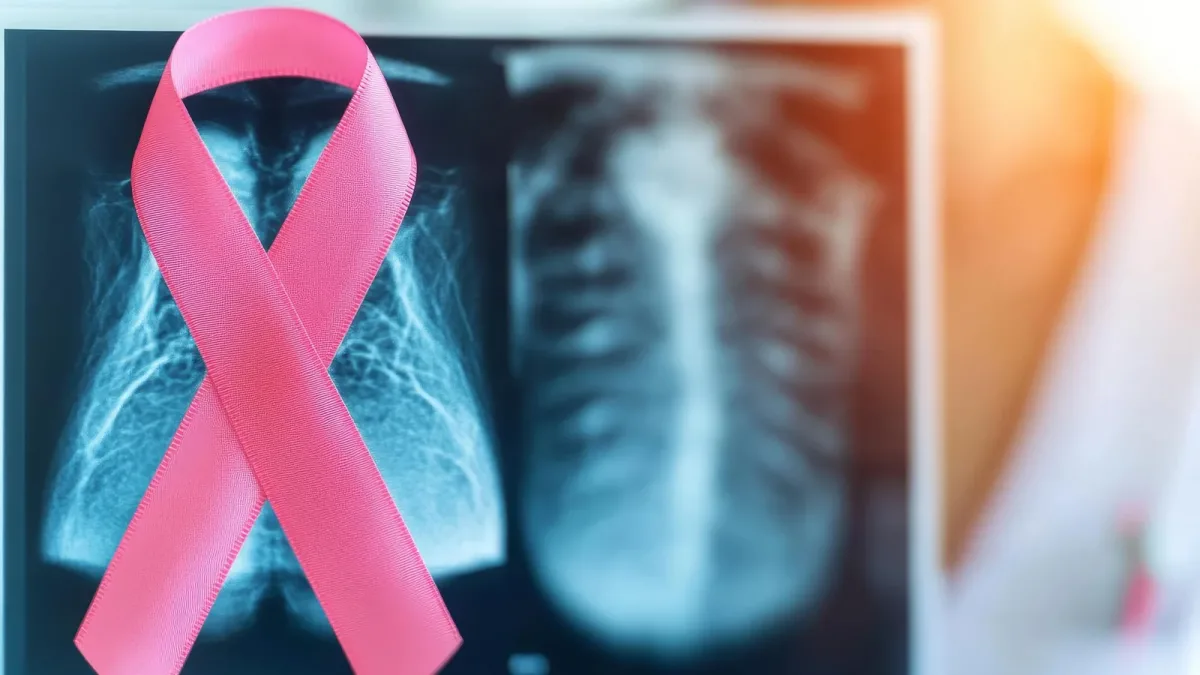 94 % de réponses sous zidesamtinib : un résultat réservé aux cancers du poumon ROS1