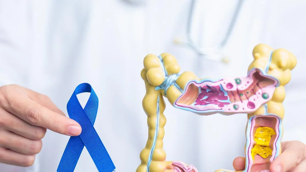 Docteur tenant un ruban bleu avec un modèle d'anatomie du côlon humain March Colorectal Can